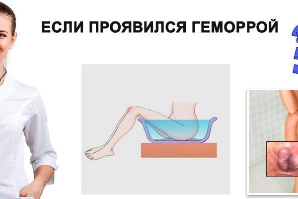 Ссылка на кракен площадка